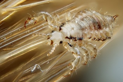 Head Lice | Richland Health