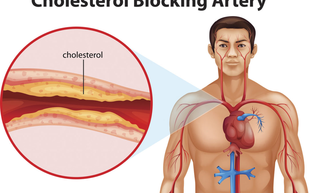 Cholesterol Awareness Month